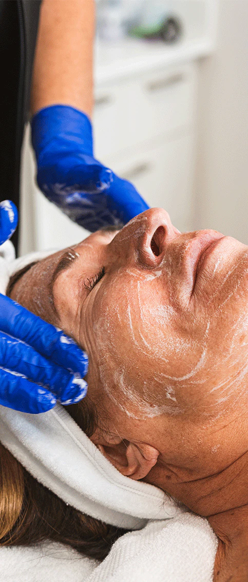 Femme qui reçoit un soin peeling chimique à la clinique ÜMAN.
